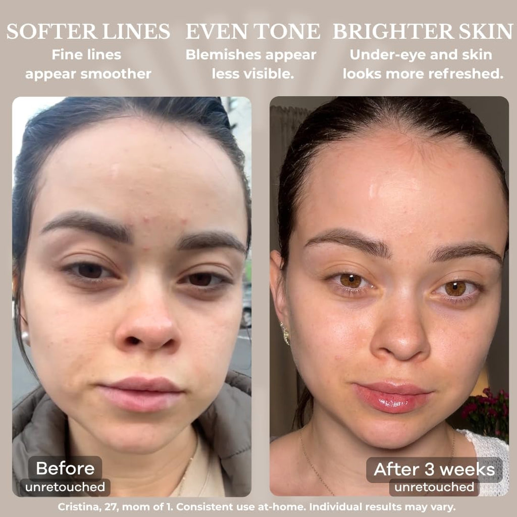 LED Light Therapy Face Mask