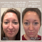 LED Light Therapy Face Mask