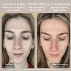 LED Light Therapy Face Mask
