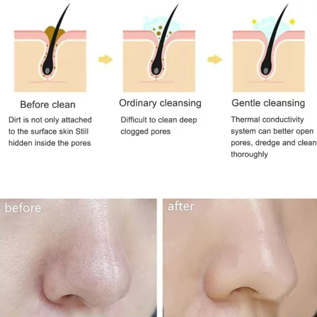 Ultra-Density Sonic Silicone Facial Cleansing Brush